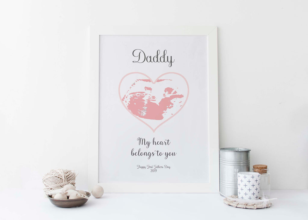 Capture the joy of fatherhood with a personalized ultrasound print, Heartfelt Father's Day gift: Personalized baby ultrasound artwork