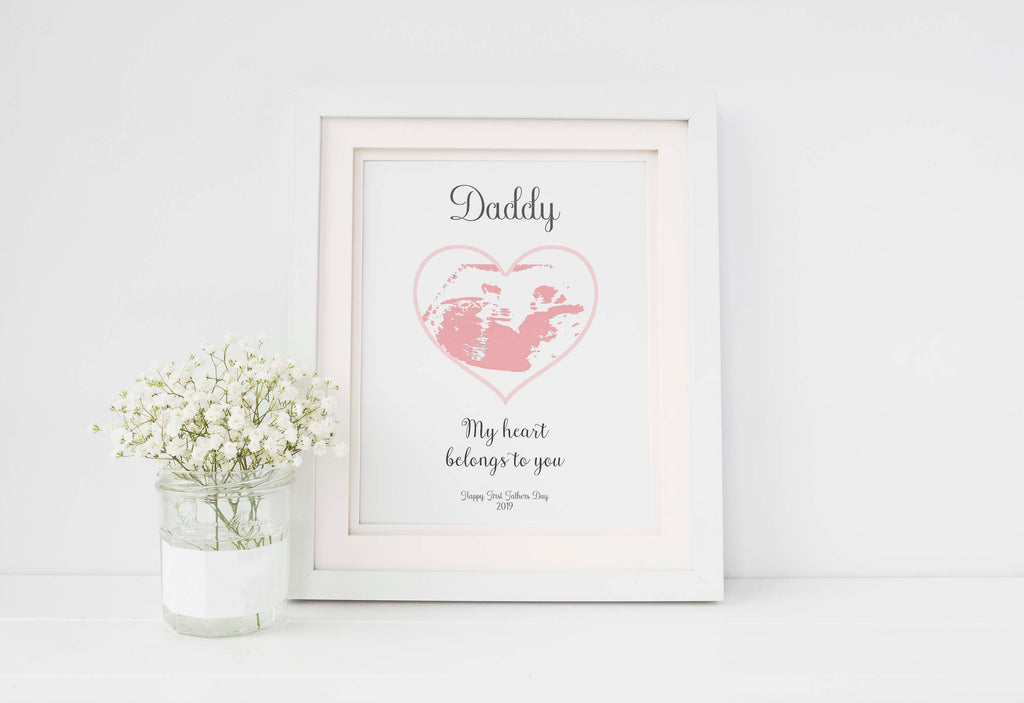 Personalized ultrasound print for Father's Day: A treasured keepsake, Colourful and customizable: Baby ultrasound print for Father's Day
