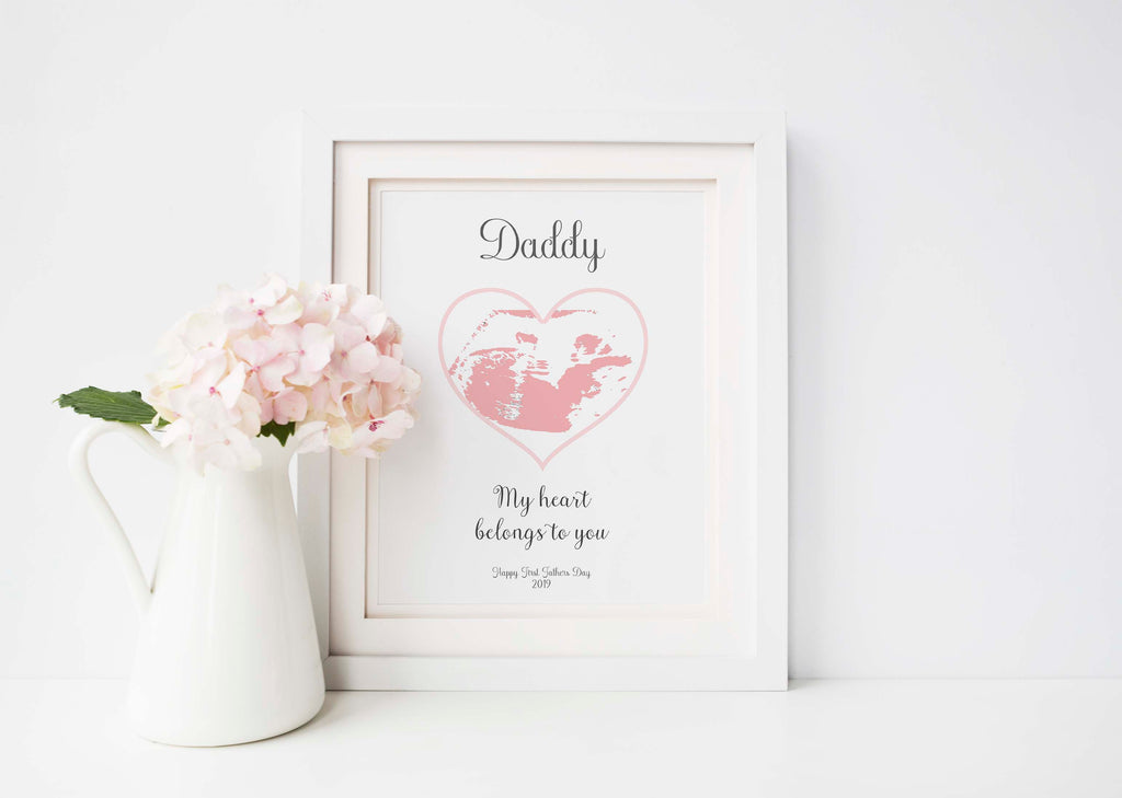 Customized baby ultrasound print for Father's Day, Unique Father's Day gift: Personalized baby ultrasound print