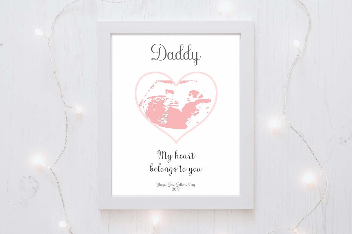 First Fathers Day Gift Idea, Sonogram Art, Fathers Day Gift from Daughter, Fathers Day Gifts for Dad